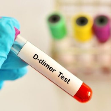 D-DIMER U TRUDNOĆI – KOMPLETAN VODIČ